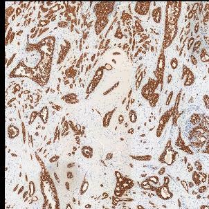 IHC